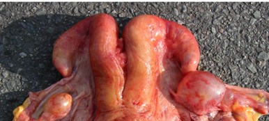 Figur 1 Follikelcyste