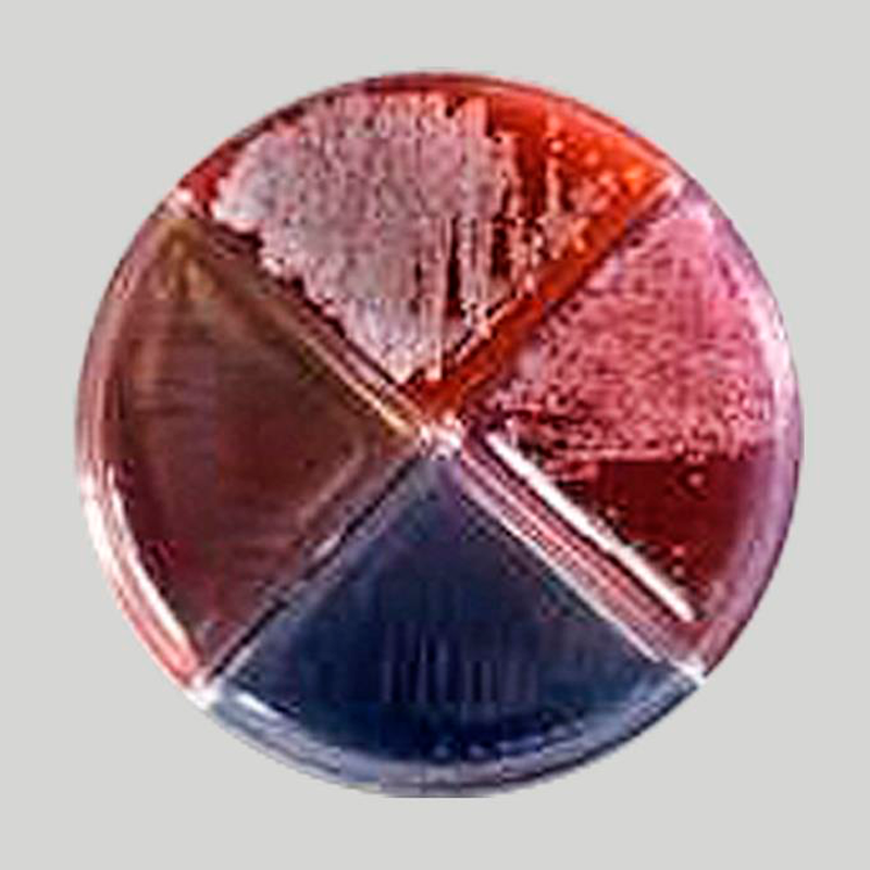 Kvæg Malkning Mælkeprøver