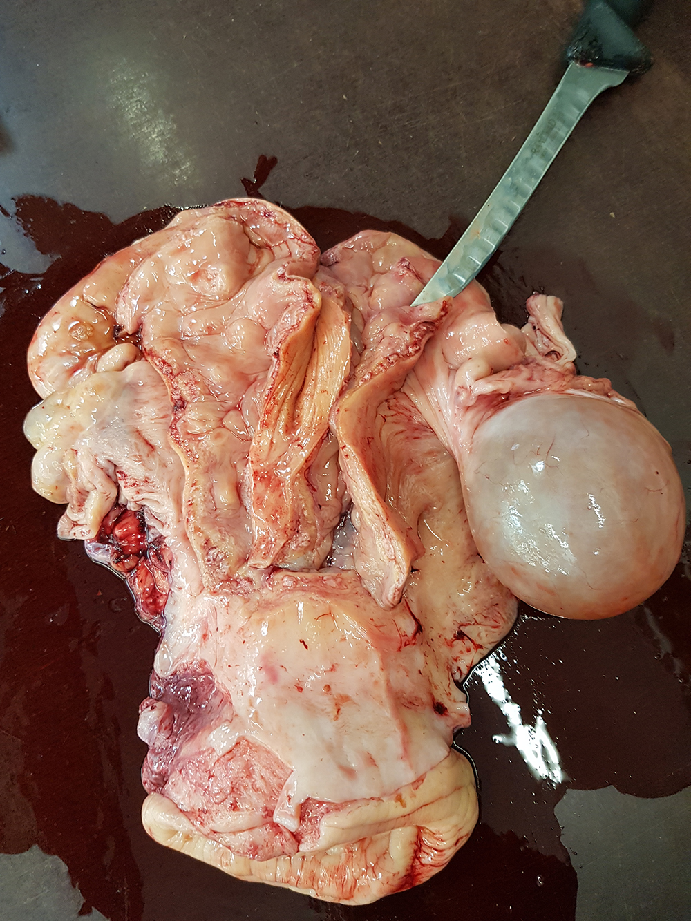 Follikelcyste Tilrettet2